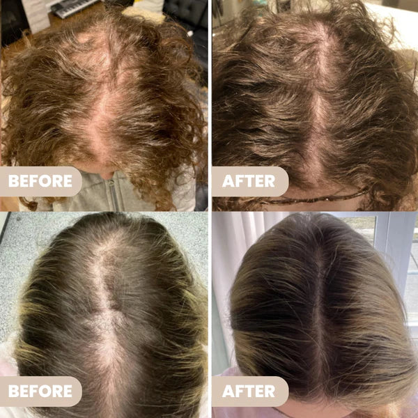 Organic Glossy & Growth Hair Oil (230 ML)